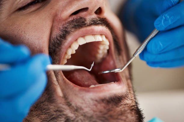 Best Emergency Dental Services for Seniors in Olivehurst, CA